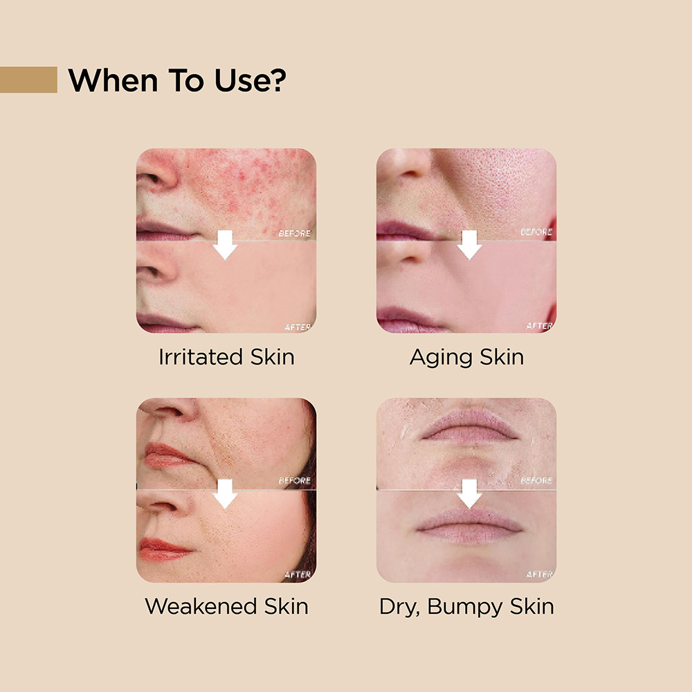 Banobagi - Milk Thistle Repair Toner - 200ml